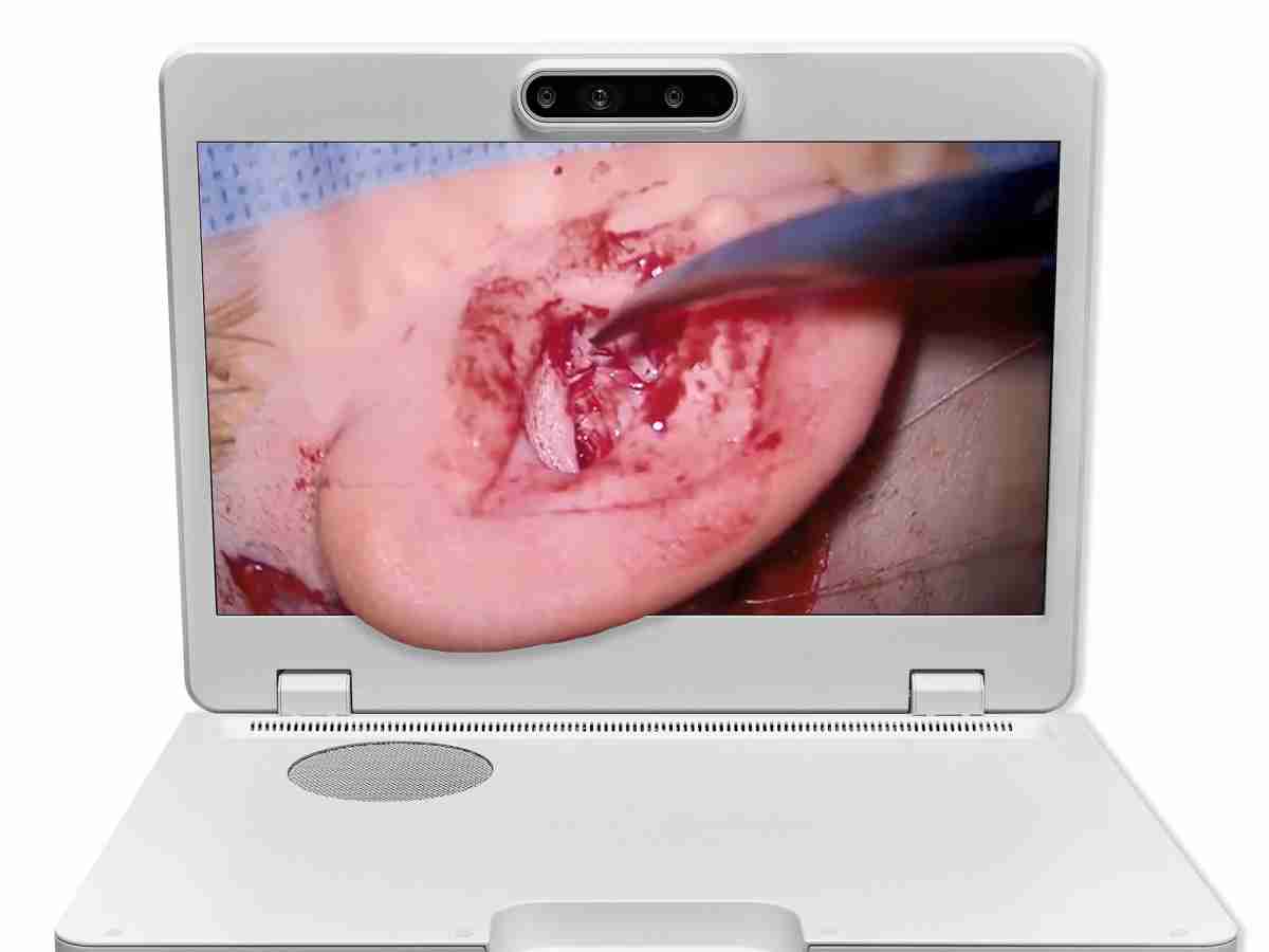 达擎之＂Heads-up 3D显微手术显示系统＂，，整合4K裸眼3D显示及眼球追踪系统，，，，具备快速追踪人眼移动位置功能，，，减轻医师长时间维持固定姿势的负担，，让医师能有更宽广清晰的3D立体视野及更舒适的姿势来执行手术。。